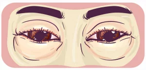 Despídete de los puffy eyes