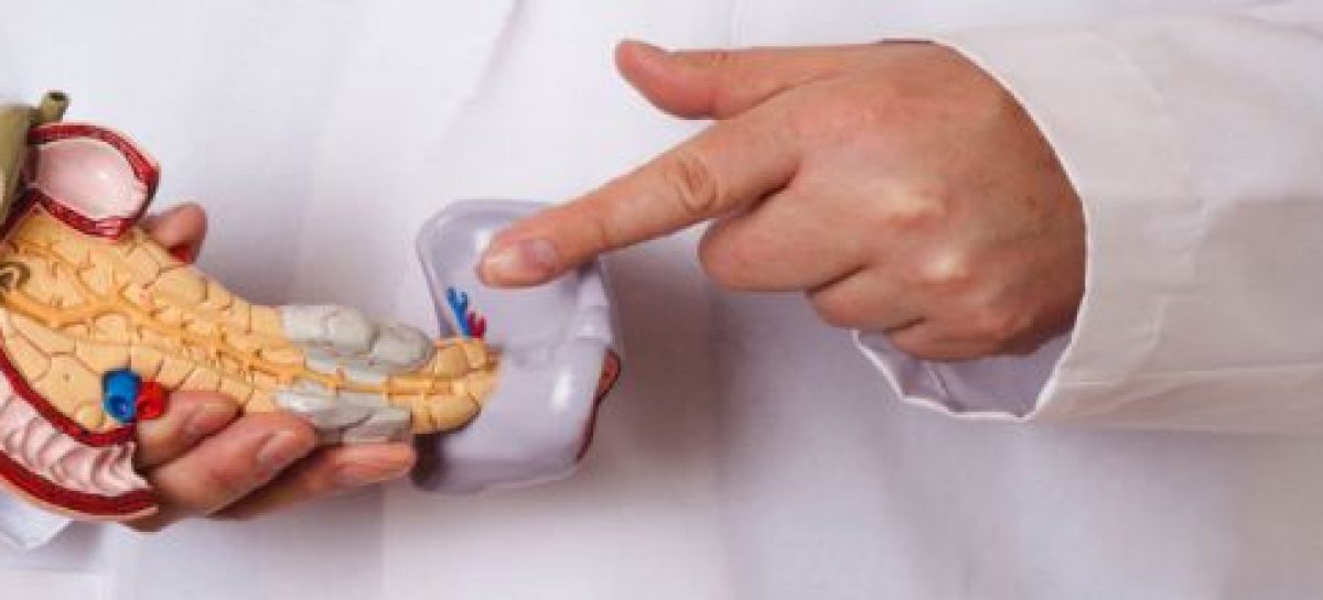Cáncer de páncreas: ¿Qué es y qué lo causa?