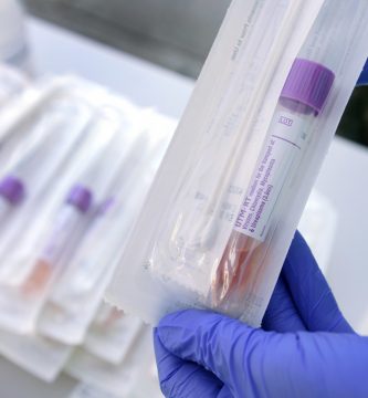 ¿Cómo funcionan las pruebas de Covid-19?