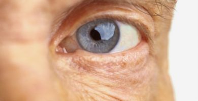 Degeneración macular asociada con la edad: ¿Qué es y cómo prevenirla?