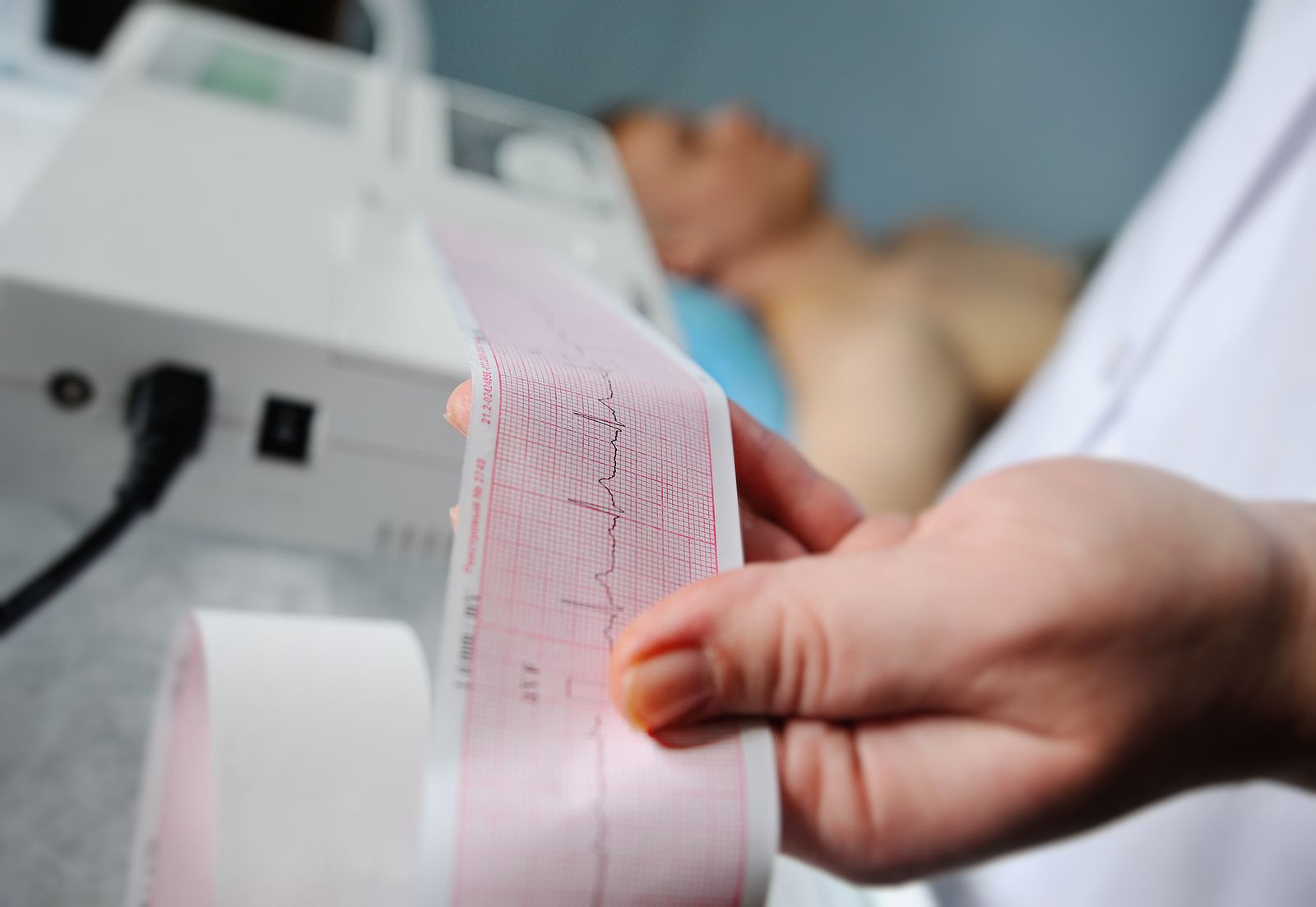 Electrocardiograma Electrocardiograma: ¿Qué Es Y Cuánto Cuesta?