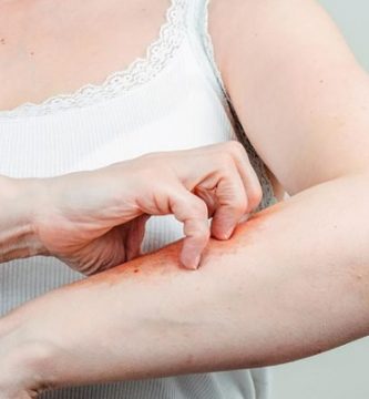 ¿Qué medicamento es bueno para infecciones en la piel?