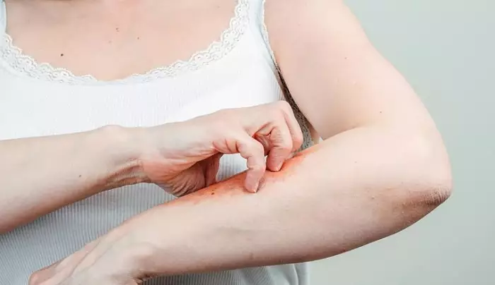 ¿Qué medicamento es bueno para infecciones en la piel?