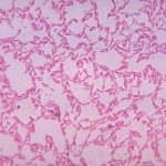 ¿Qué es la Bacteroides fragilis y qué enfermedades causa?