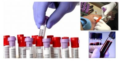Química sanguínea de 12 elementos: ¿Qué es?