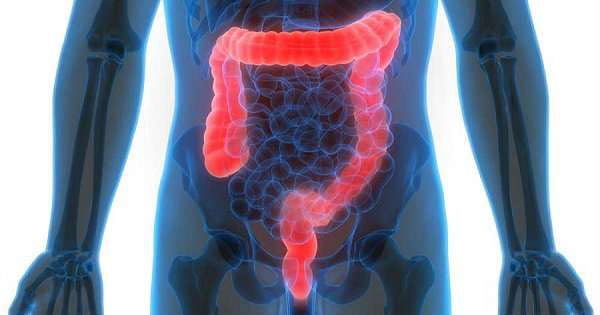 Síndrome del colon irritable: ¿Qué es?