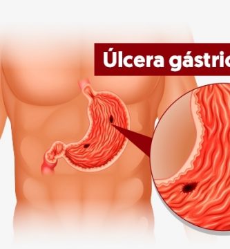Úlcera gástrica: ¿Qué es?