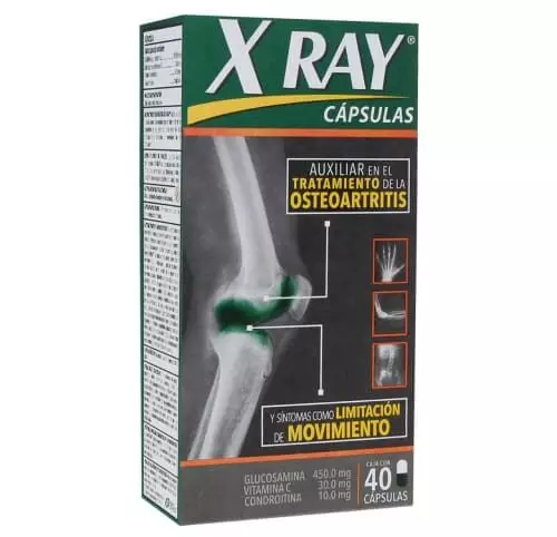 X-Ray: ¿Qué es y para qué sirve?