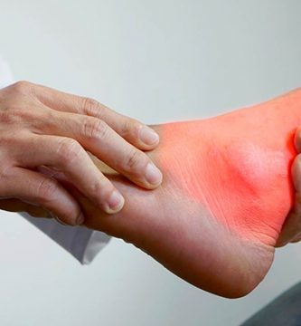 Pastillas para el ácido úrico: ¿Cuáles son las mejores?