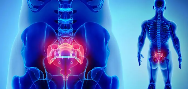 Medicamentos para la ciática: ¿Cuáles son los mejores?