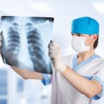Radiografías a domicilio: ¿Qué son?