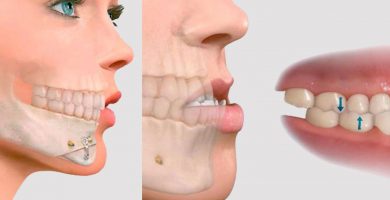 Cirugía Maxilofacial: ¿Qué es y para qué sirve?
