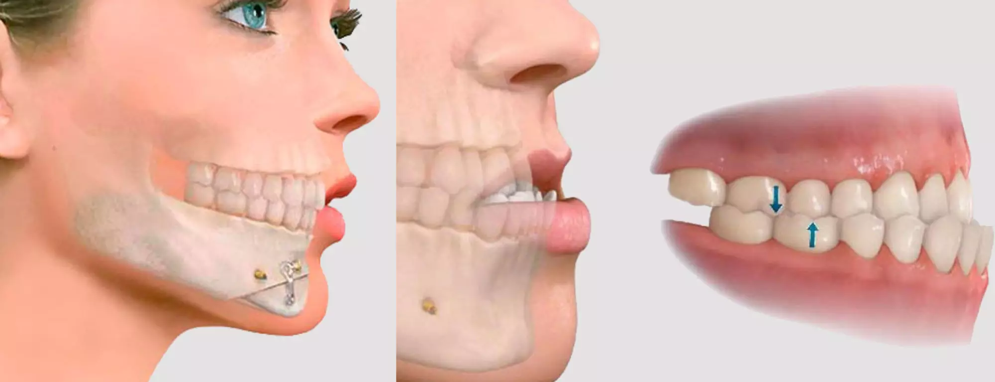Cirugía Maxilofacial: ¿Qué es y para qué sirve?