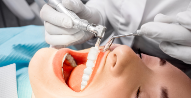 Limpiezas Dentales: ¿Qué son y para qué sirven?