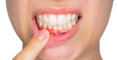 Periodoncia: ¿Qué es y para qué sirve?