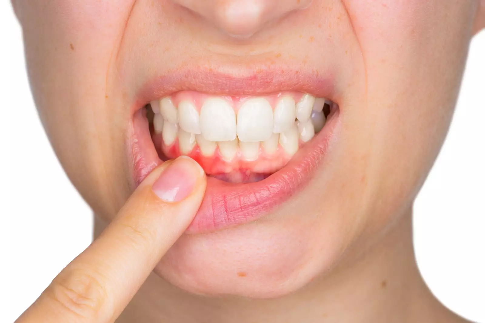Periodoncia: ¿Qué es y para qué sirve?