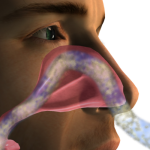 Solvopret alivio de la rinosinusitis