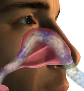 Solvopret alivio de la rinosinusitis